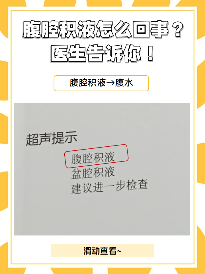 怎样判断是否腹部积水图片