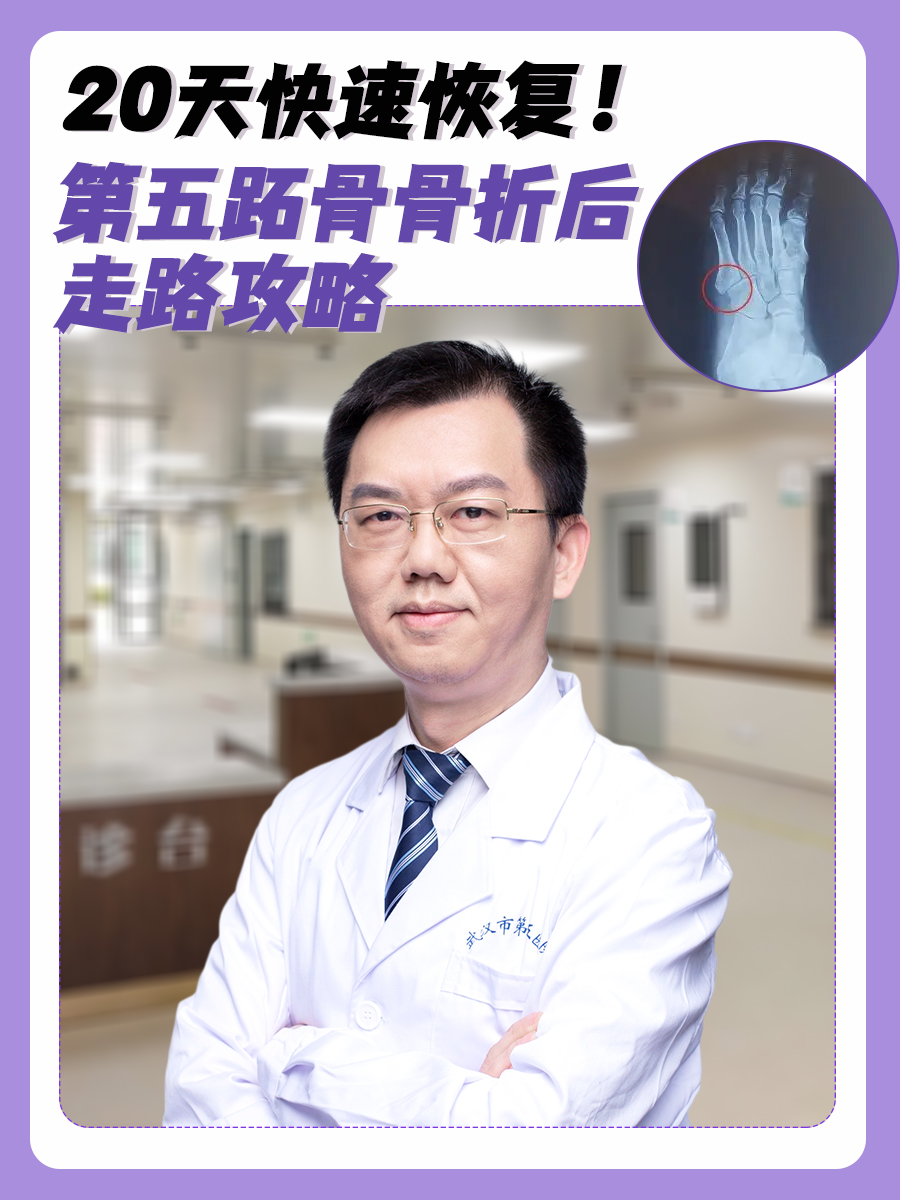 第五跖骨骨折后走路攻略