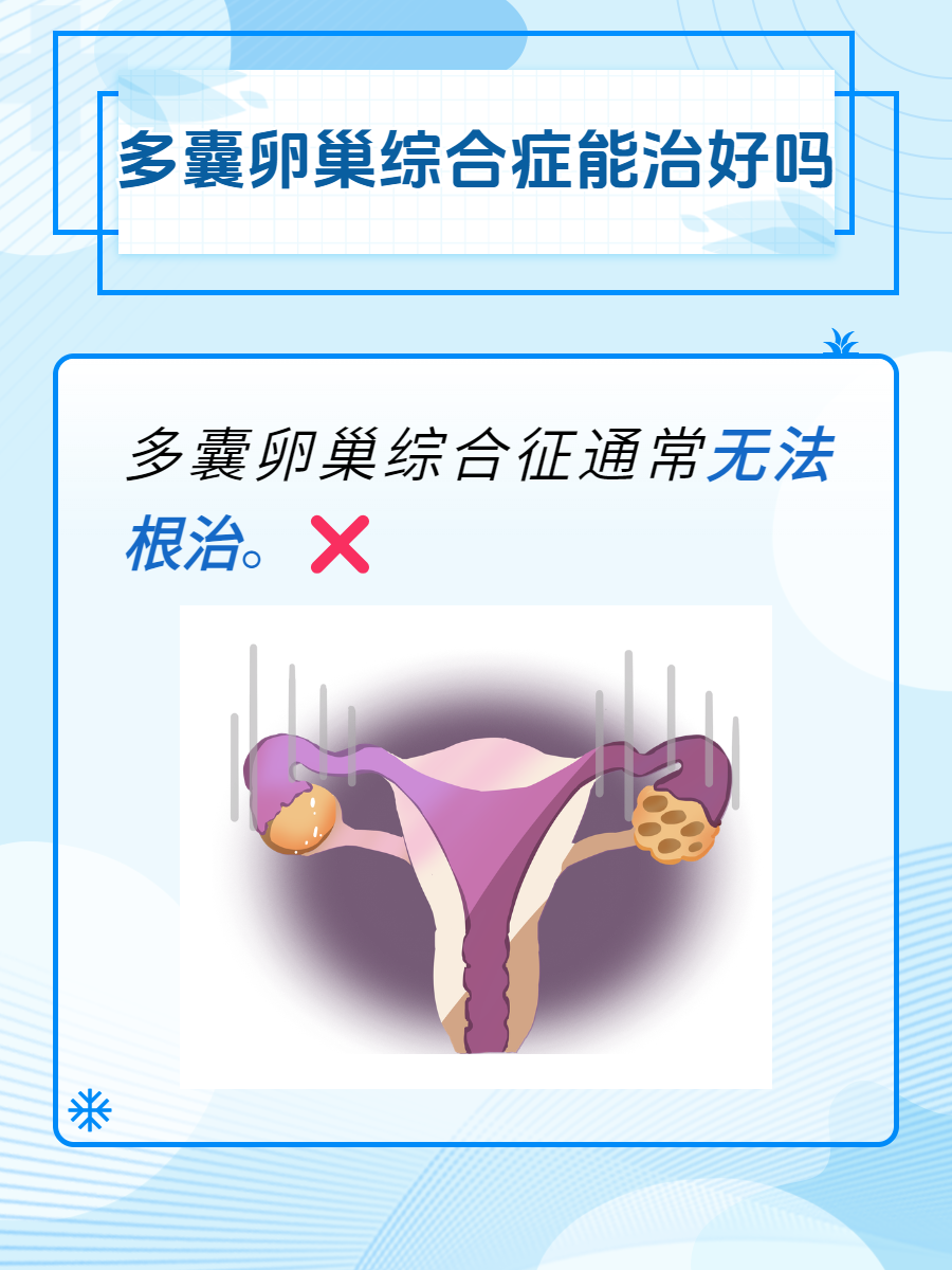 多卵巢多囊怎么治疗_卵巢多囊怎么治疗能当月怀孕