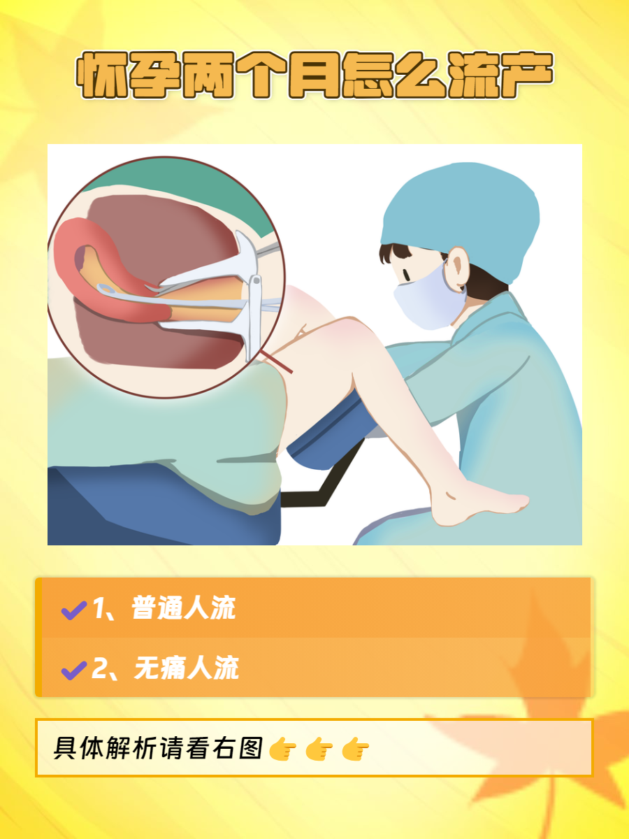 终止妊娠最佳处理方法