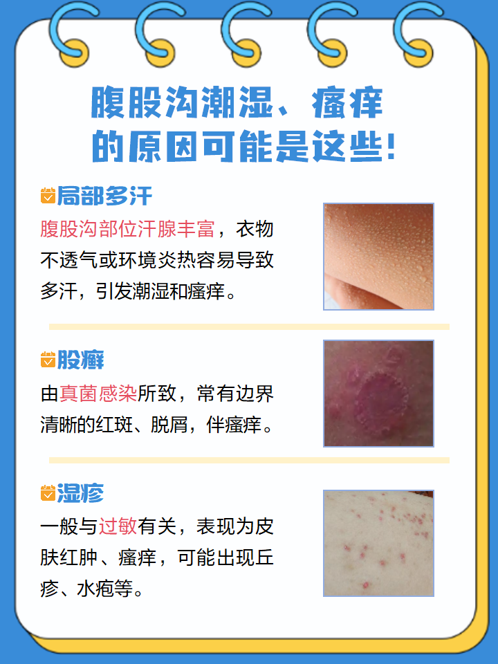 腹股沟湿疹腹股沟痒腹股沟湿疹图片股癣图片腹股沟瘙痒是什么原因引起