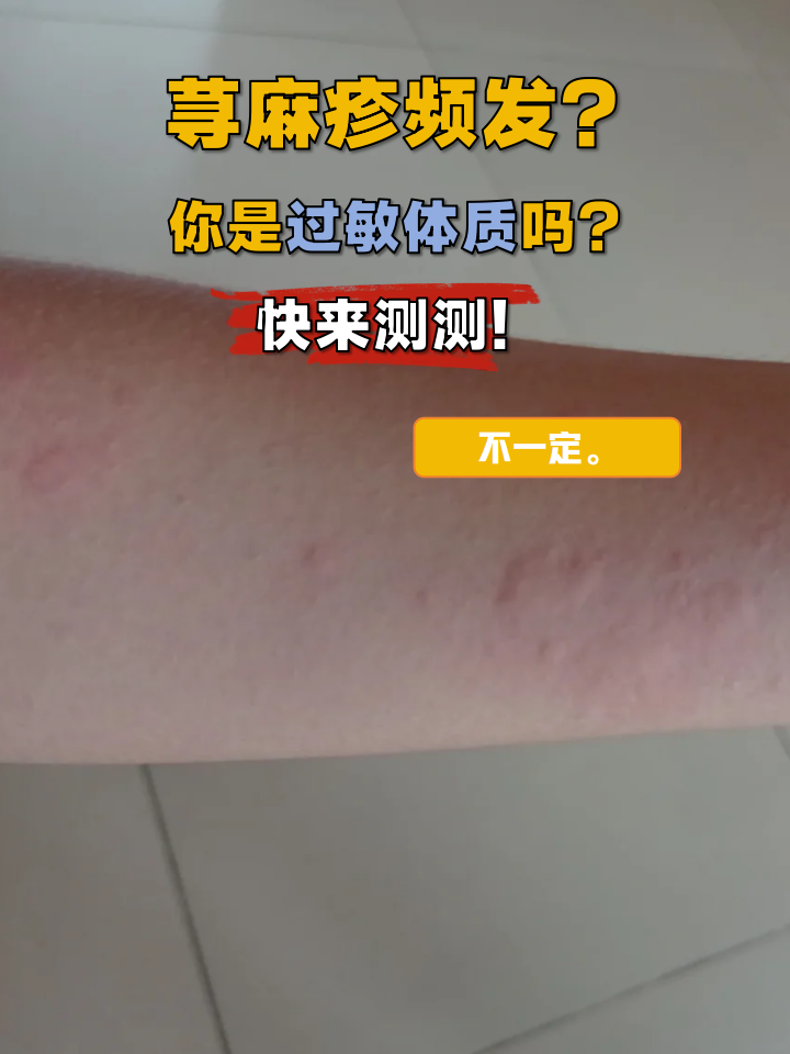 皮肤为什么会过敏