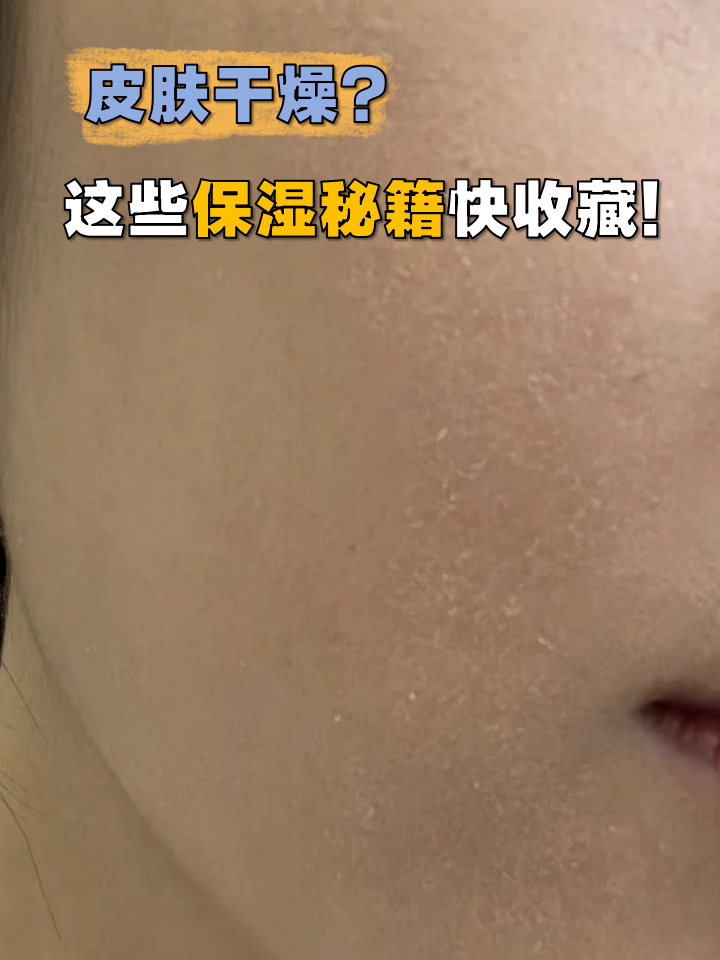 为什么抹了素颜霜会脱皮为什么在线 为什么抹了素颜霜会脱皮为什么在线