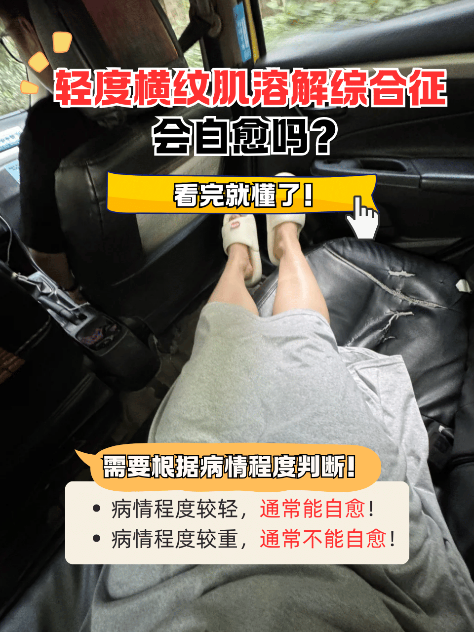 看完就懂了!  你有没有出现过轻度横纹肌溶解综合征的情况呢?