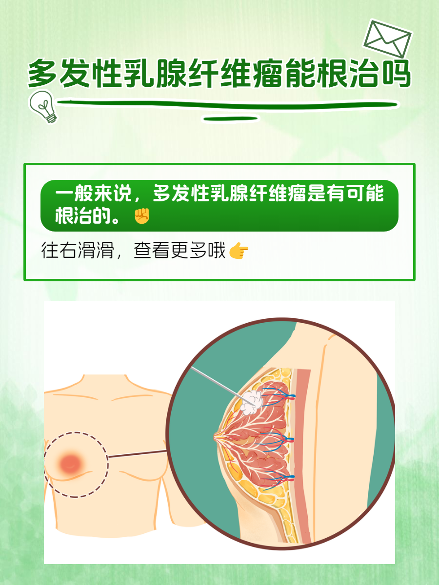 乳腺纤维瘤的位置图片图片