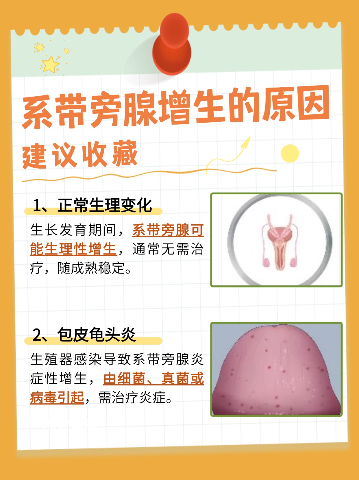 在探讨男性生殖健康的议题时,系带旁腺增生这一现象时常被提及