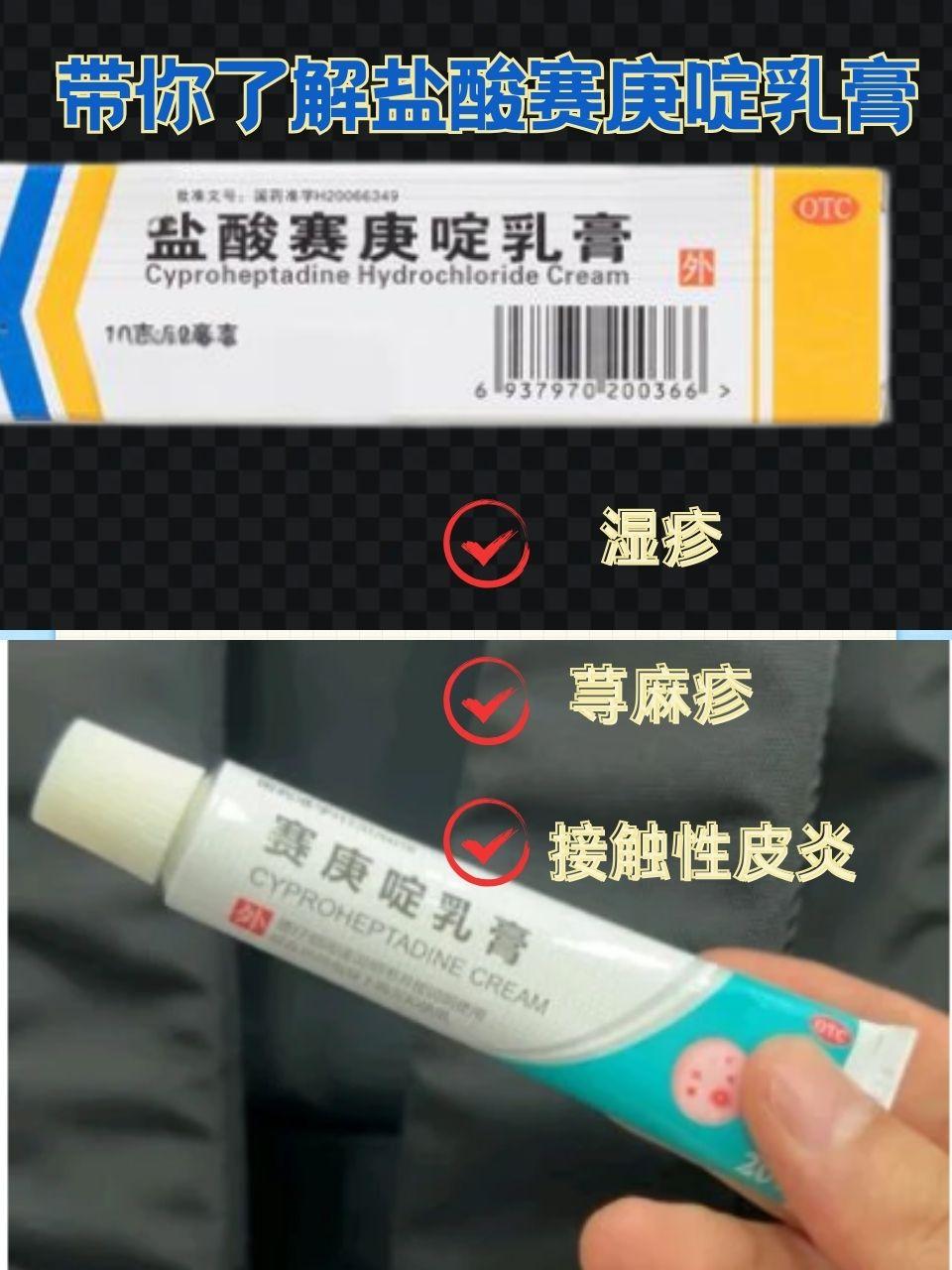 和湿疹用什么药物蠓虫叮咬后涂什么药膏皮肤病用什么药特效盐酸软膏