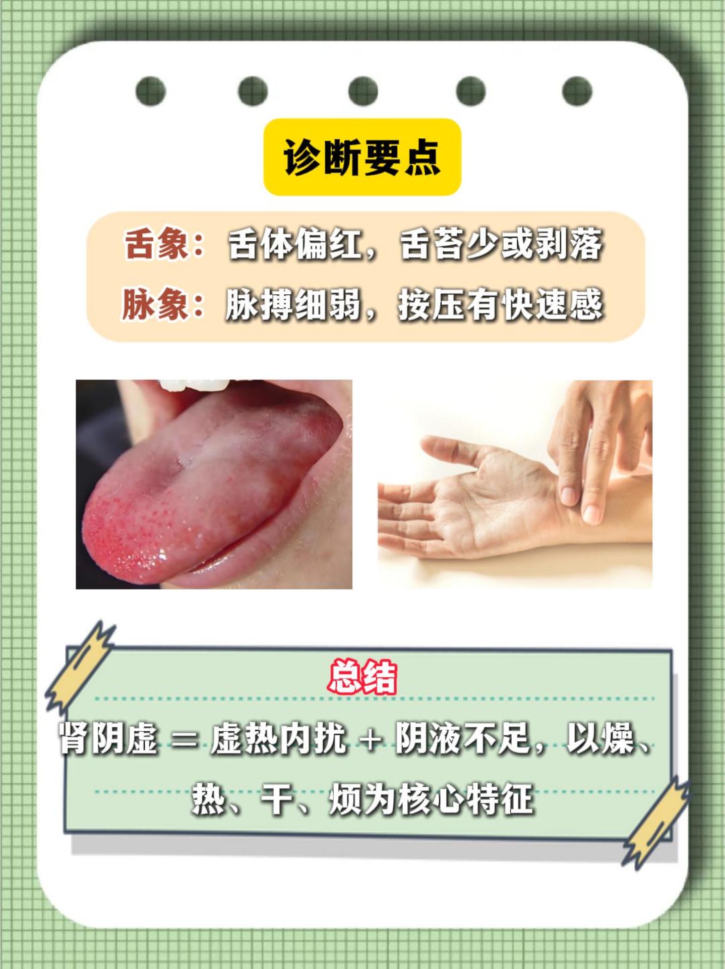 肾阴虚的人