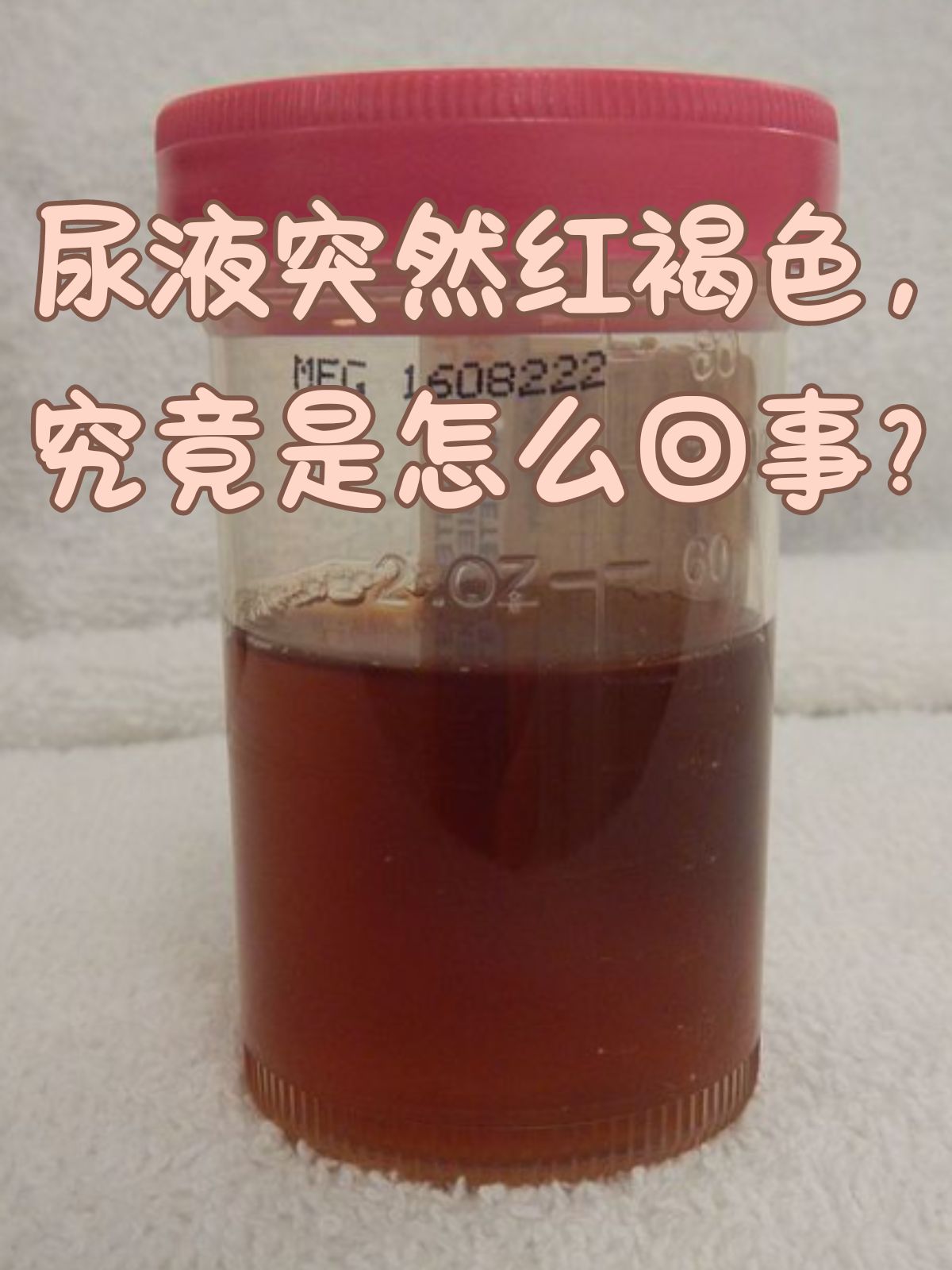 当男性突然发现自己的尿液变成红褐色时,那种惊慌和担忧