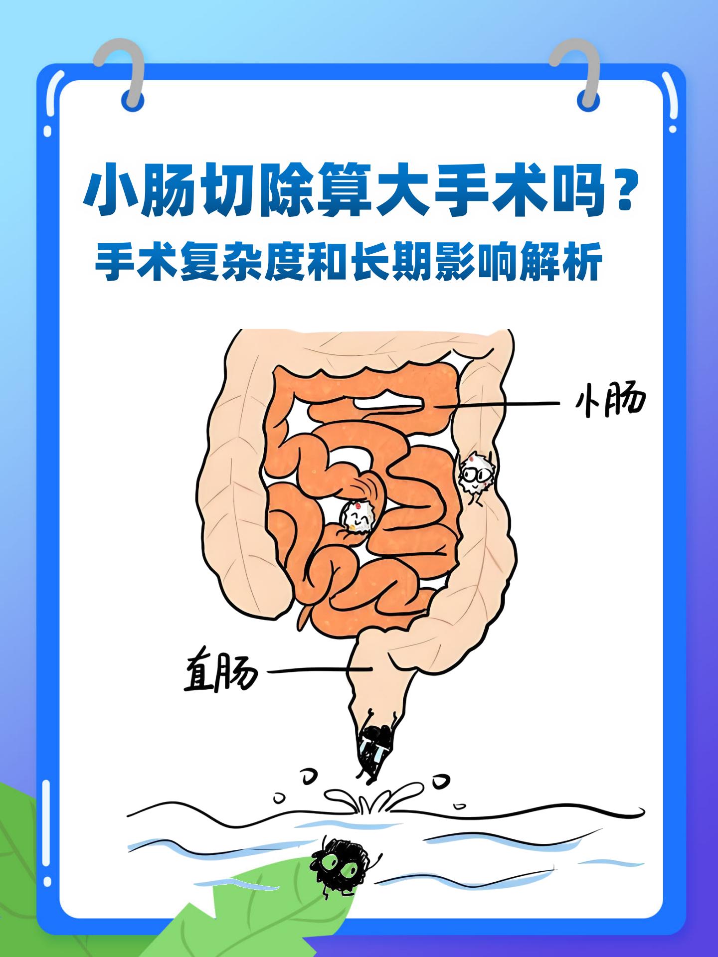 小肠切除算大手术吗?