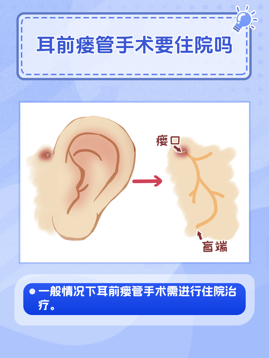 大家应该都听说过耳前瘘管手术,耳前瘘管是临床上比较常见的一种