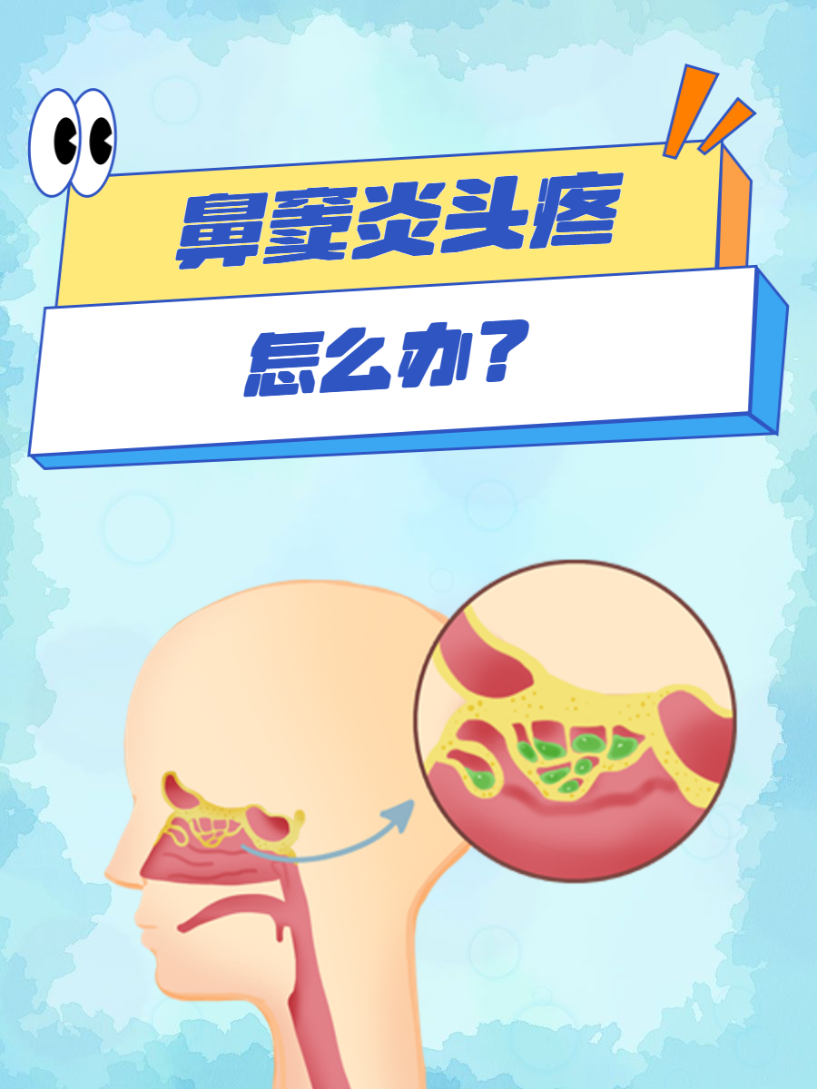 为什么会得鼻窦炎?为什么在线