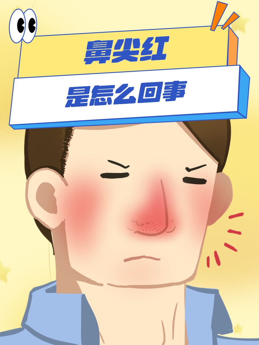 为什么鼻子总是痒痒的然后还长痘痘为什么在线