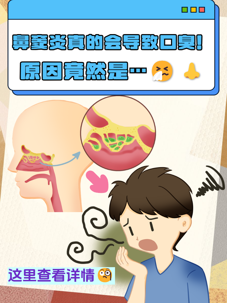为什么鼻屎多 为什么鼻屎多