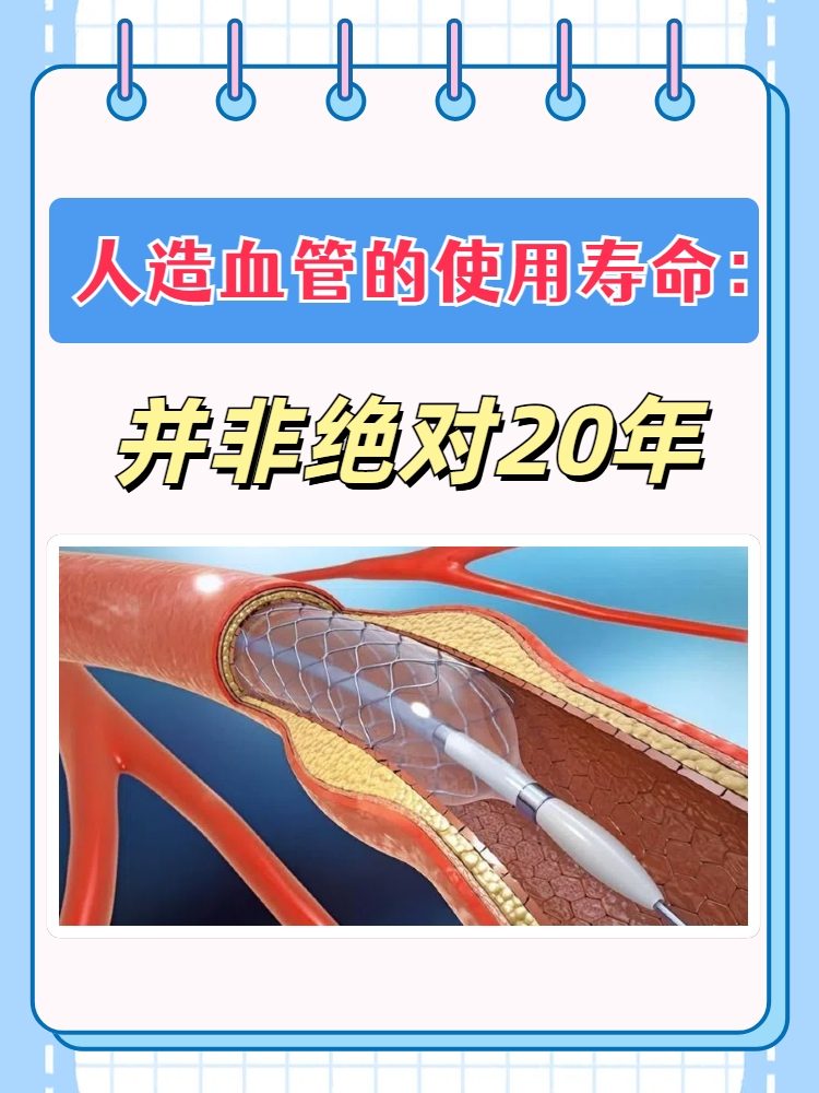 人造血管的使用寿命:并非绝对20年 人造血管的使用寿命并不是绝对的20