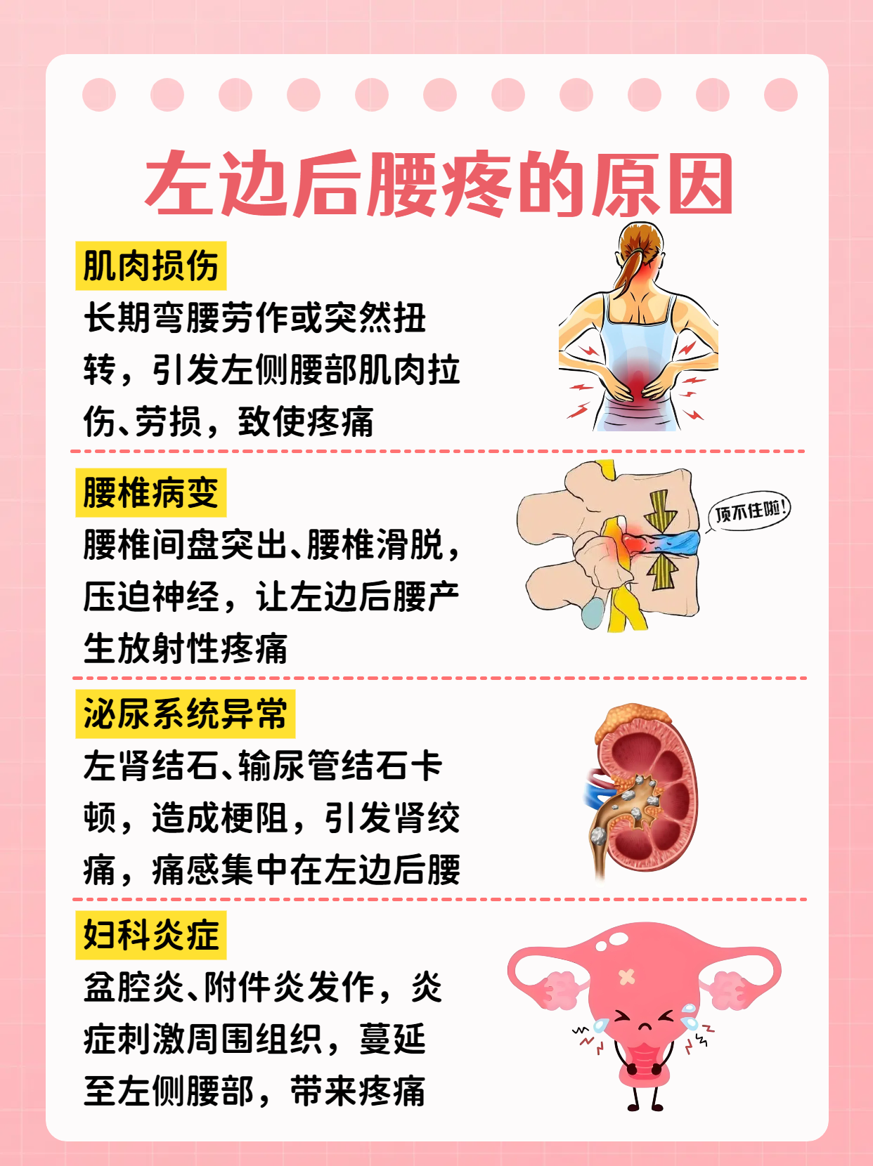为什么会腰肌劳损