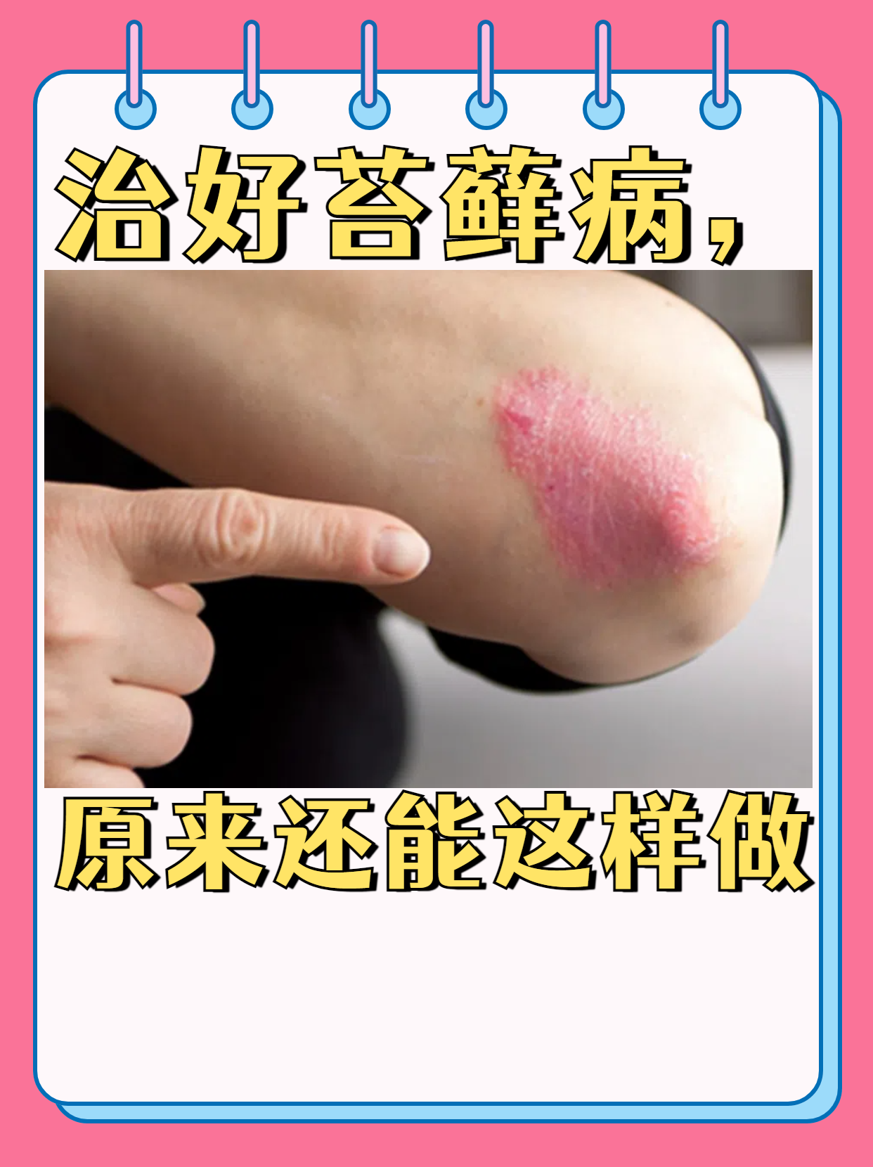 关于回龙观医院陪诊代挂号复杂病情综合分析,治疗方向更明确的信息 关于回龙观医院陪诊代挂号复杂病情综合分析,治疗方向更明确的信息