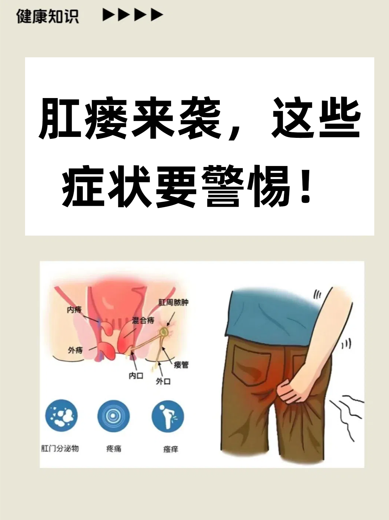 肛瘘来袭,这些症状要警惕!