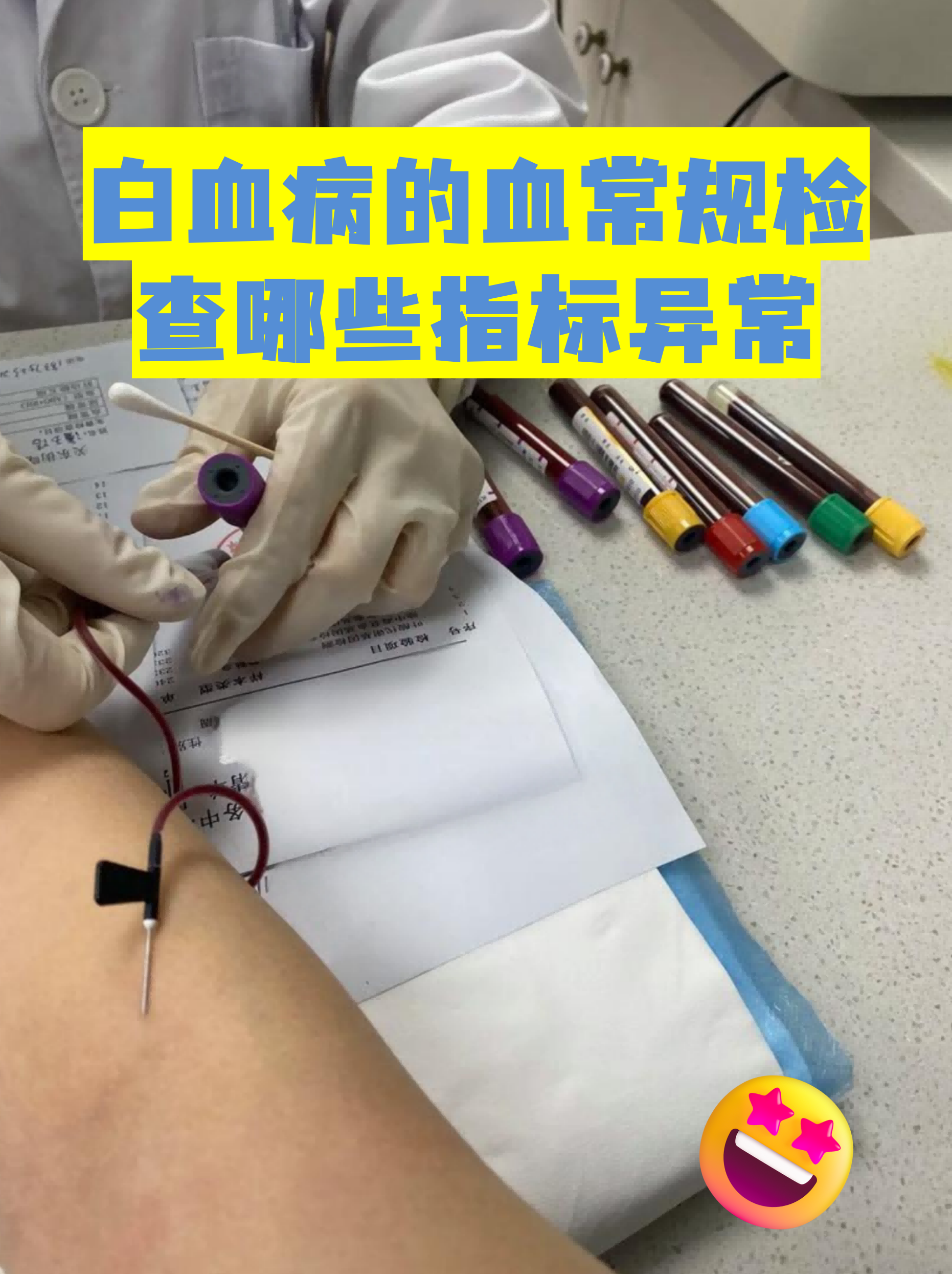 白血病的血常规检查哪些指标异常