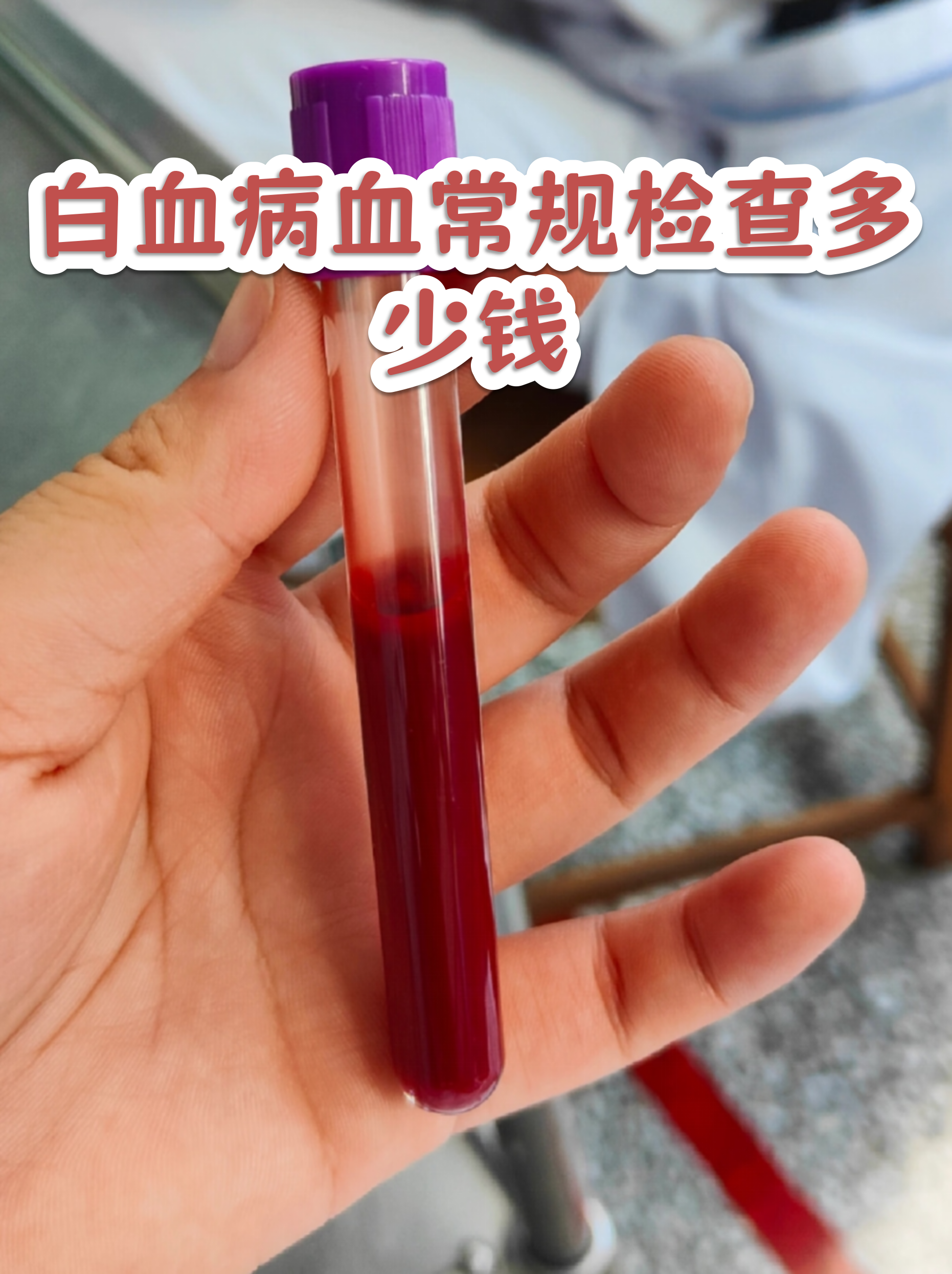 白血病血常规检查多少钱