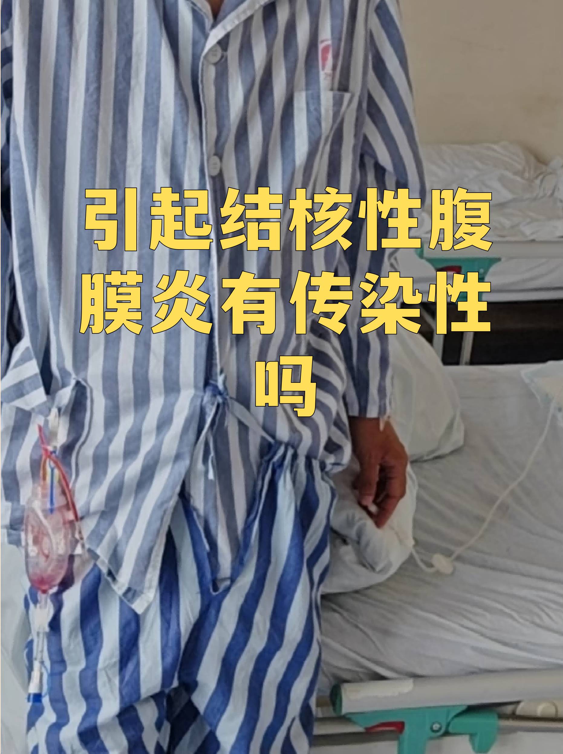 这种疾病由结核分枝杆菌感染引起但传染性与其来源和传播途径密切