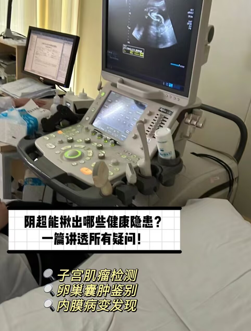 阴超能揪出哪些健康隐患?一篇讲透所有疑问!