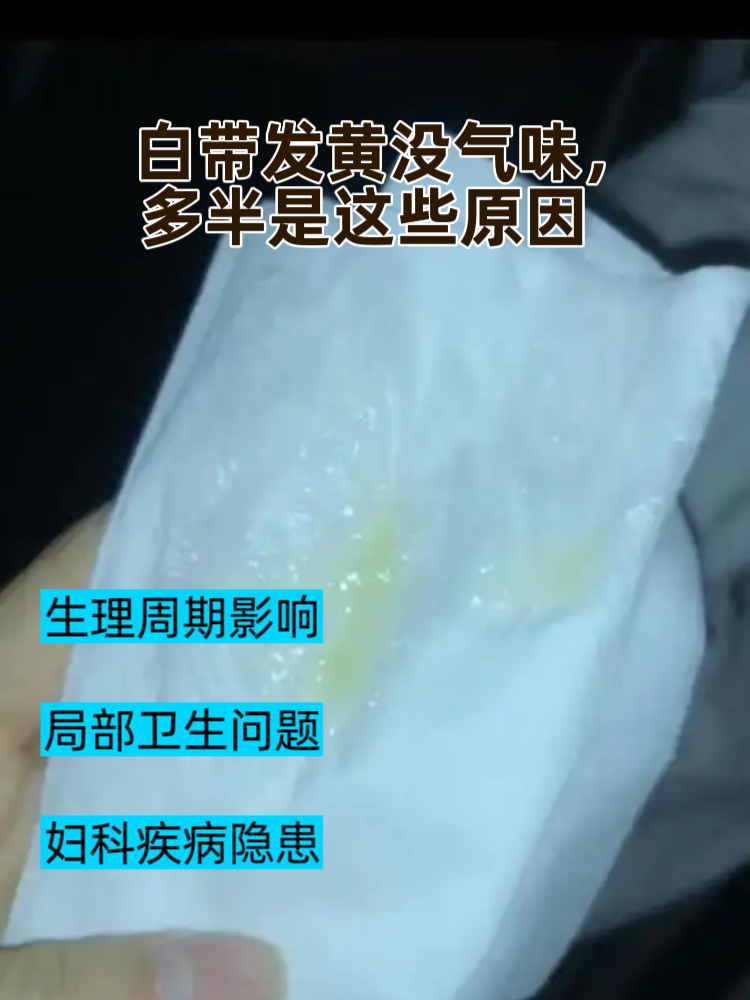 为什么没有分泌物正常吗百科在线 为什么没有分泌物正常吗百科在线