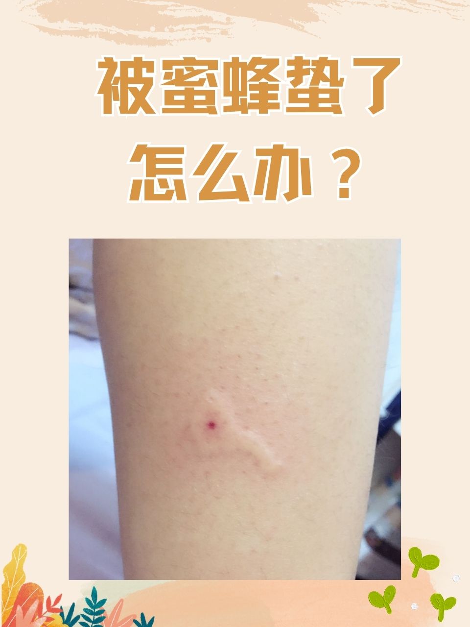 如果不幸被蜜蜂蛰了,别慌!
