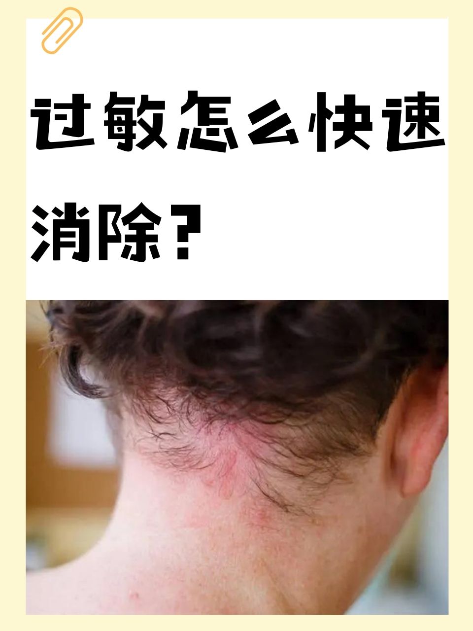 为什么身体会出现过敏症状？
