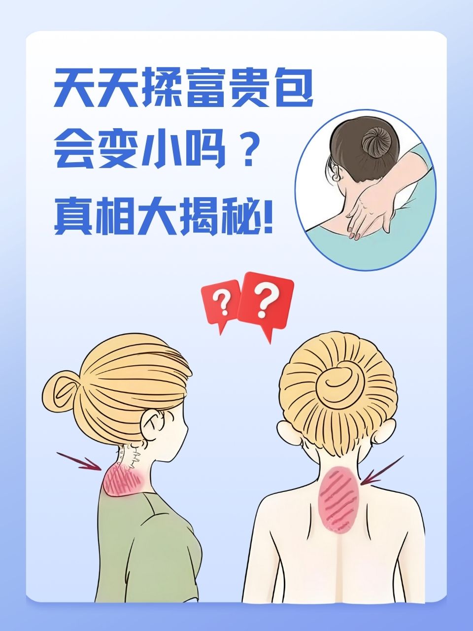 包含为什么有富贵包是什么原因引起的的词条
