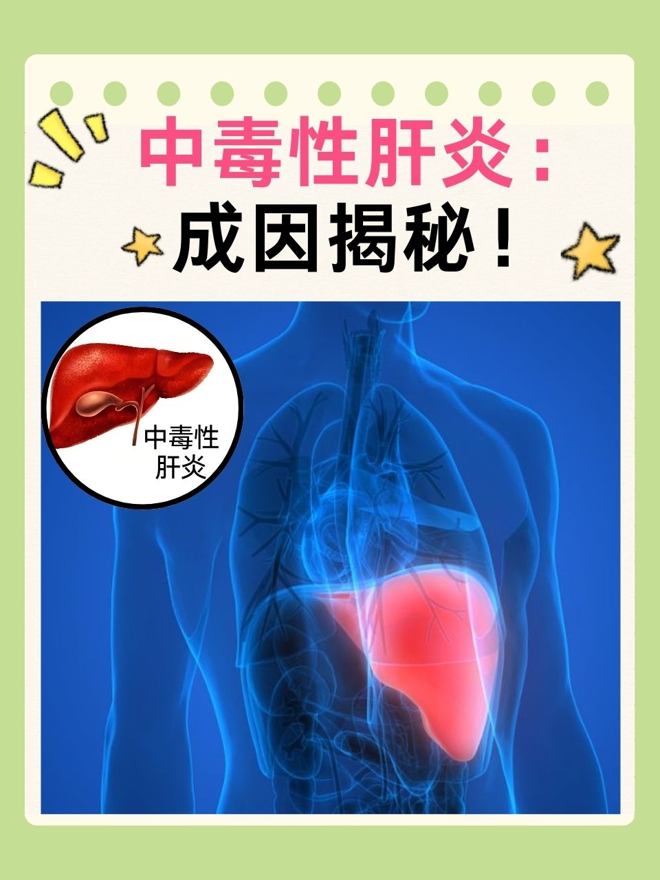 然而,有一种名为中毒性肝炎的疾病,正悄然威胁着我们的肝脏健康