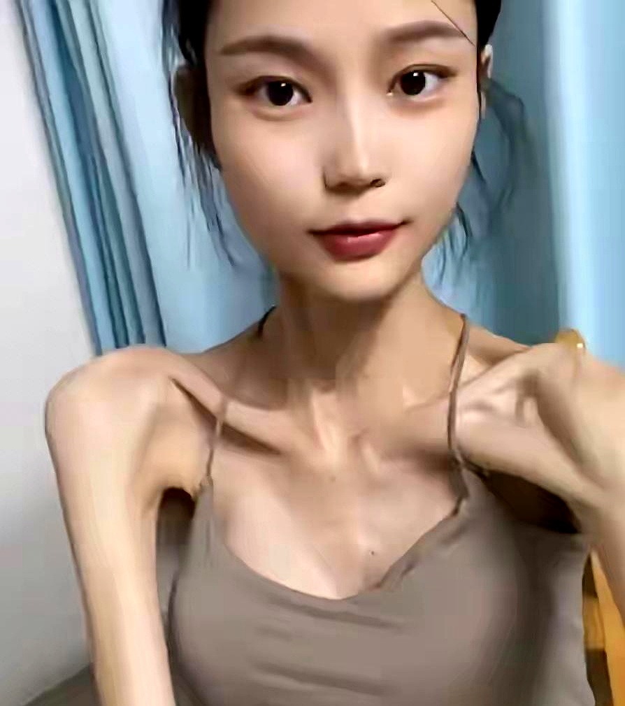 依着也很得体,跳着夸张皮包骨头皮包骨头的女孩图片最瘦的女人骨瘦如