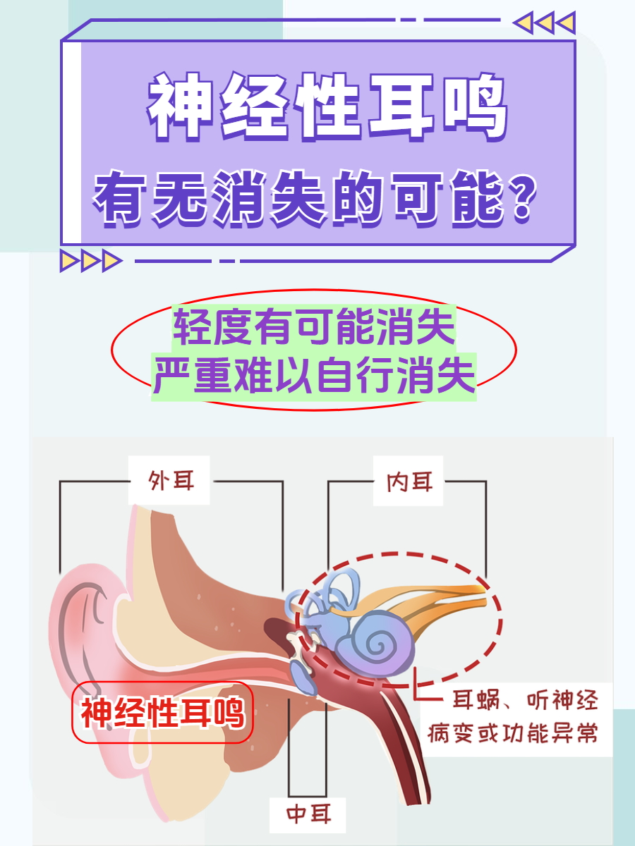 在我们的日常诊疗中,常常会遇到患者询问神经性耳鸣是否会慢慢消失
