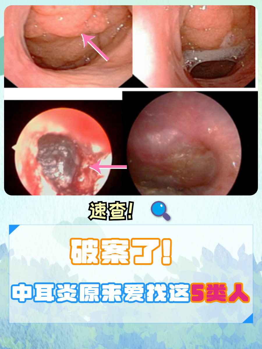 中耳炎最怕的三种药为什么在线