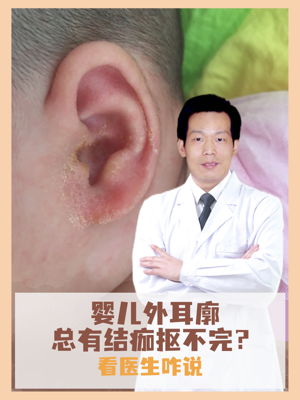 看医生咋说 👂外耳廓总有结痂抠不完是婴儿常见的小问题,如果不妥善