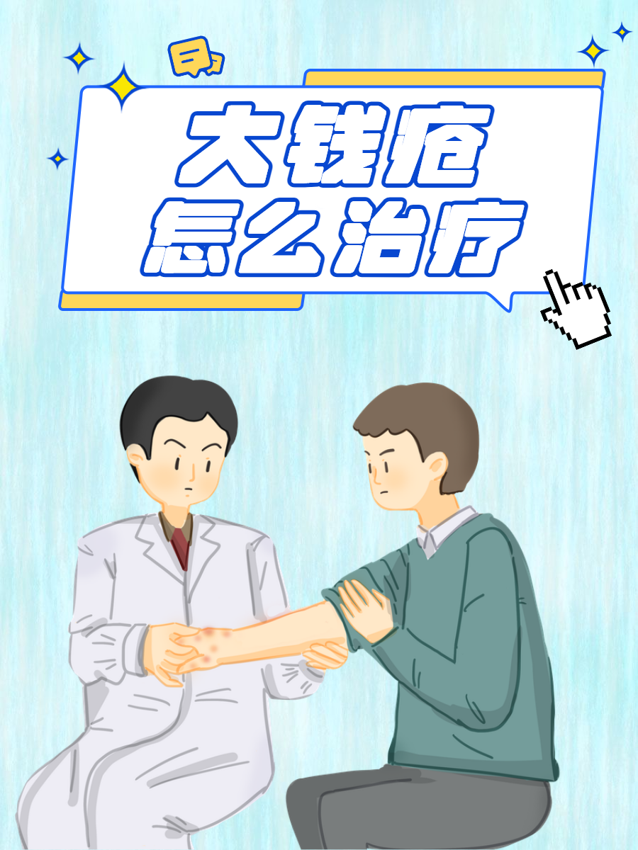 大钱疮怎么治疗?