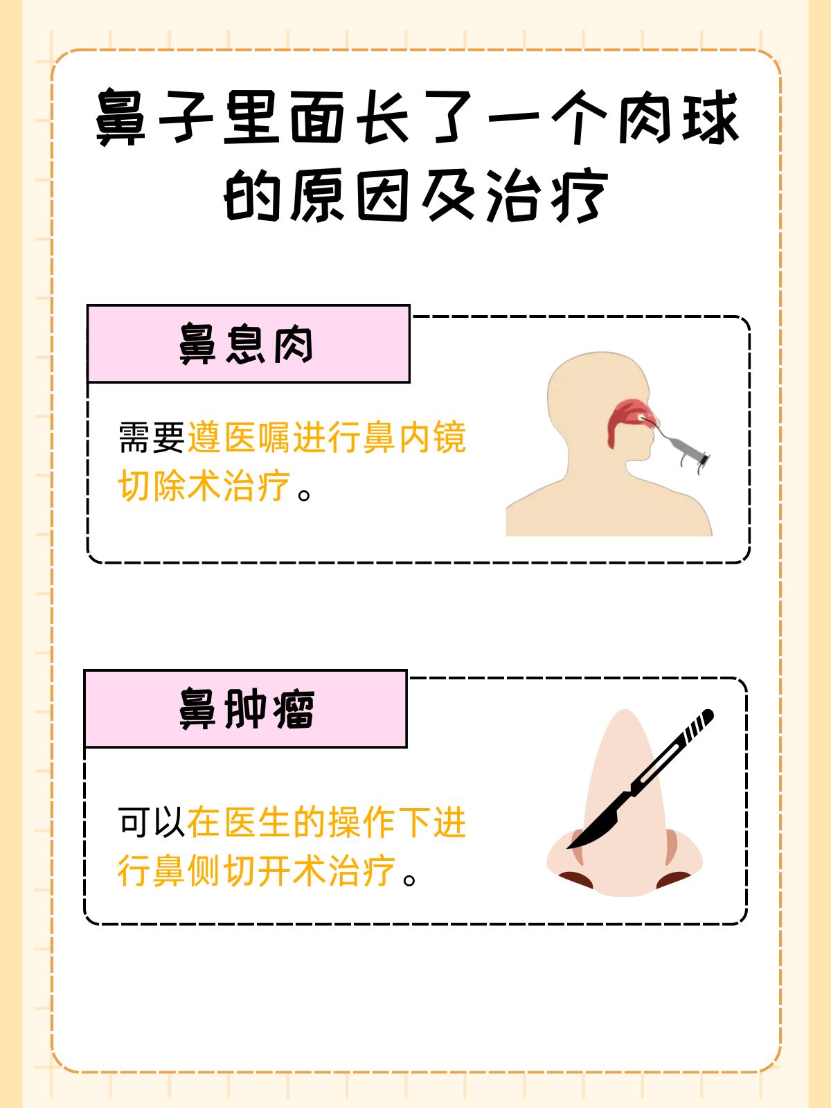 1鼻息肉