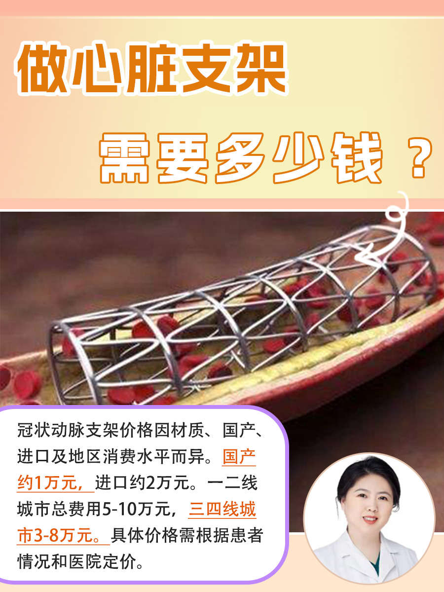 医生带你了解,做心脏支架需要多少钱 ?