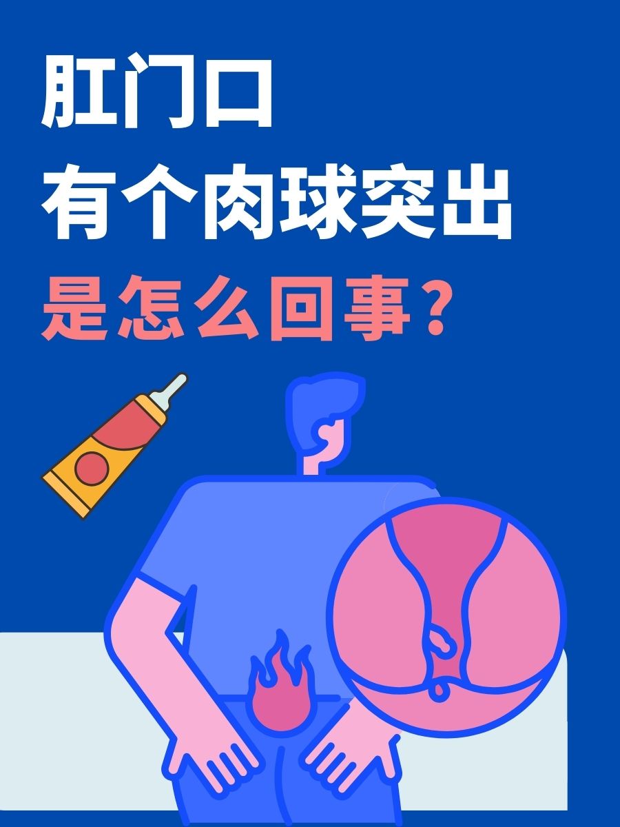 1 痔疮  2 肛裂  3 直肠息肉  4 肛周脓肿   如何预防肛门口肉球推痧