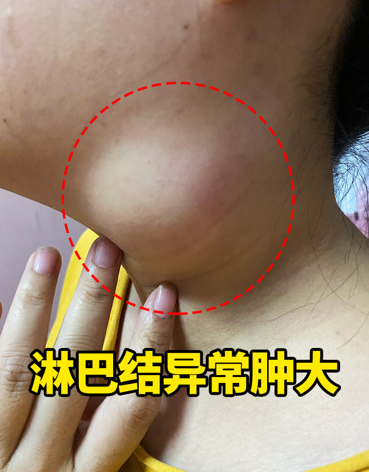 癌症,作为令人谈之色变的疾病,其转移速率始终是患者群体以及医学