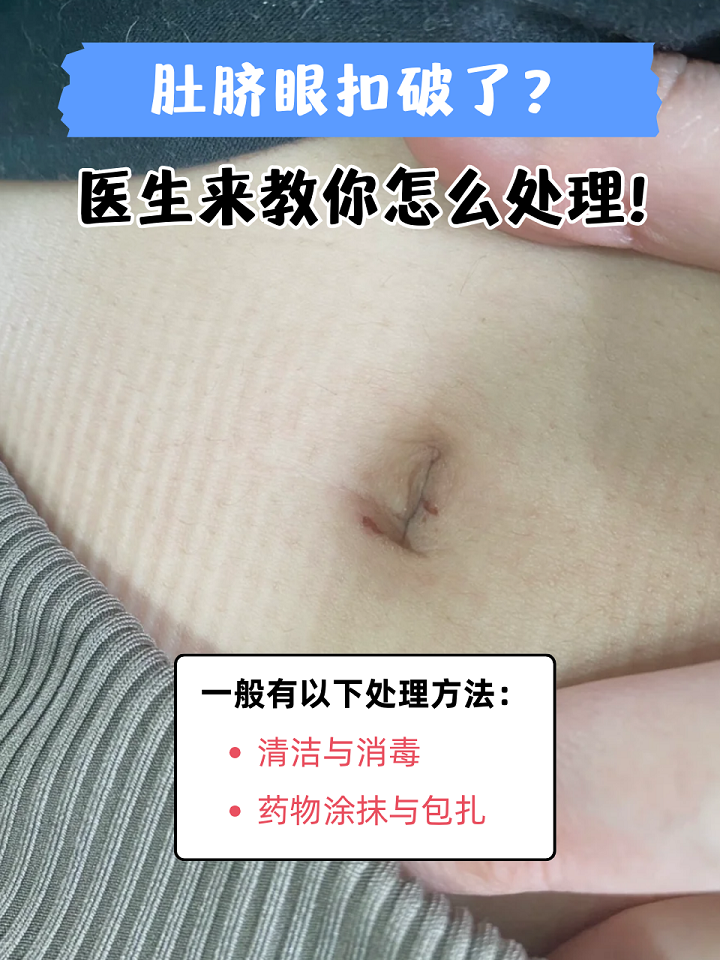 肚脐眼为什么不能抠
