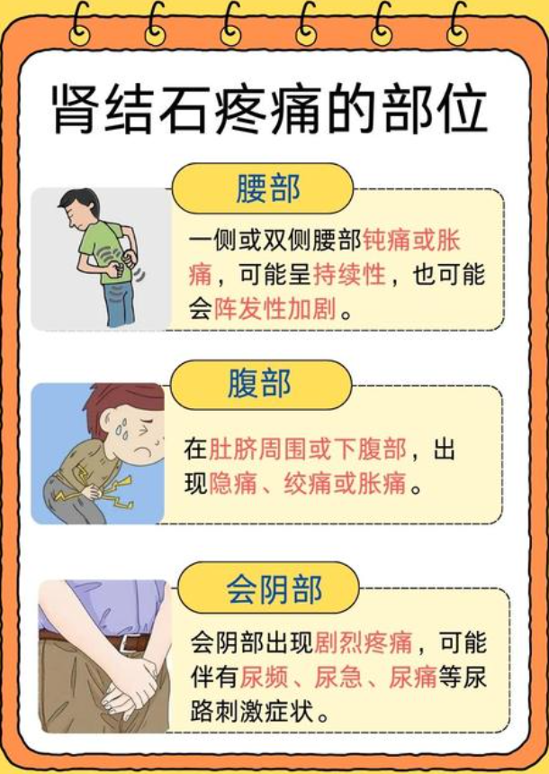 肾结石引发的疼痛位置主要在腰部和腹部