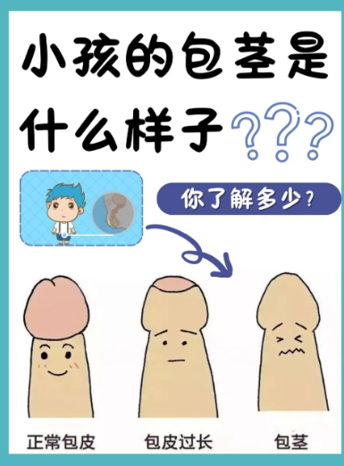 包茎则是完全覆盖,不能上翻.二者情况不同,对健康影响也有差异