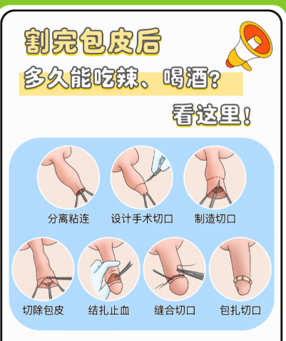 包茎手术后恢复有几个阶段