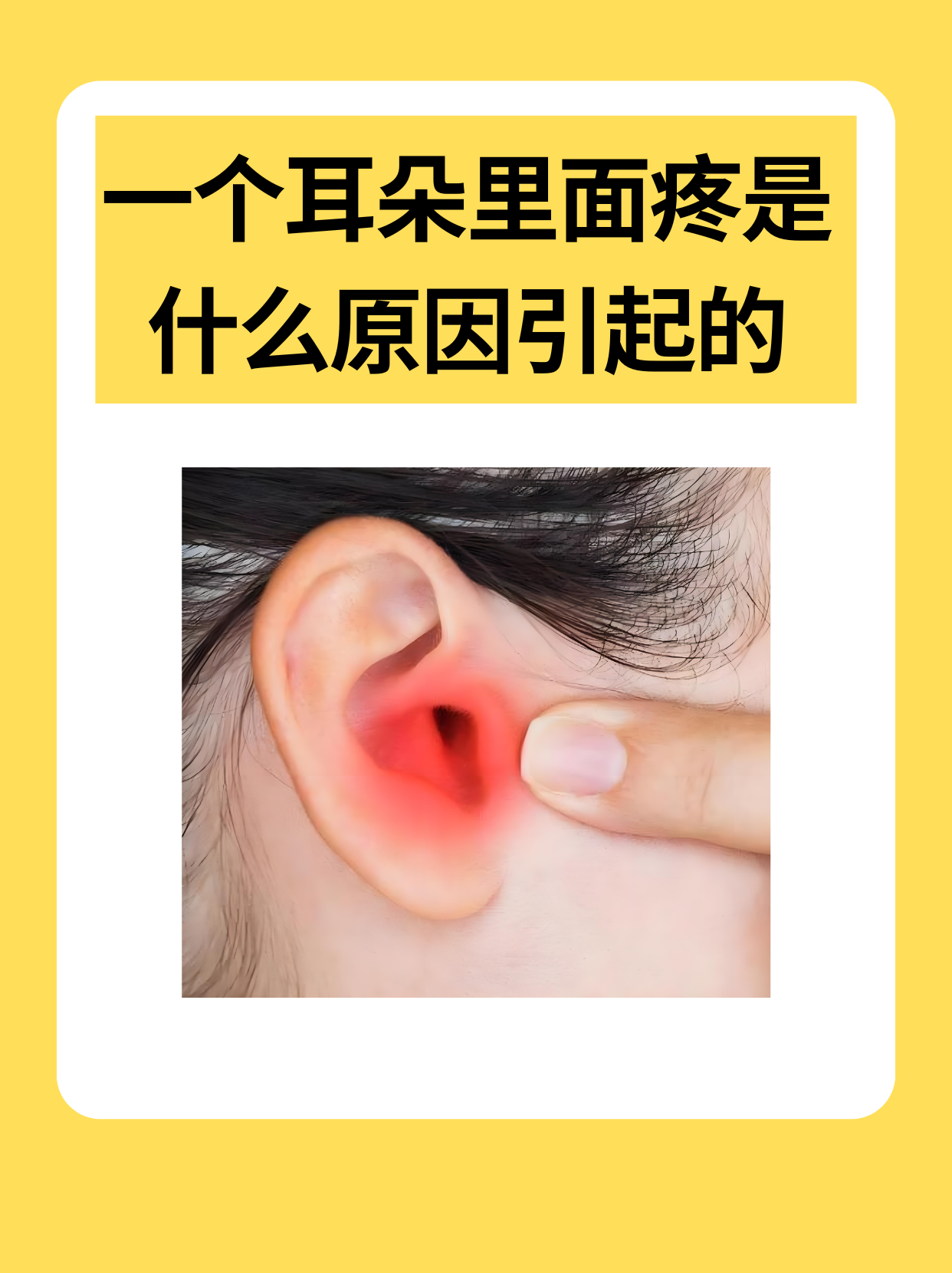 这种常见不适可能藏着多种信号,从耳垢堆积到感冒牵连的中耳炎都可能