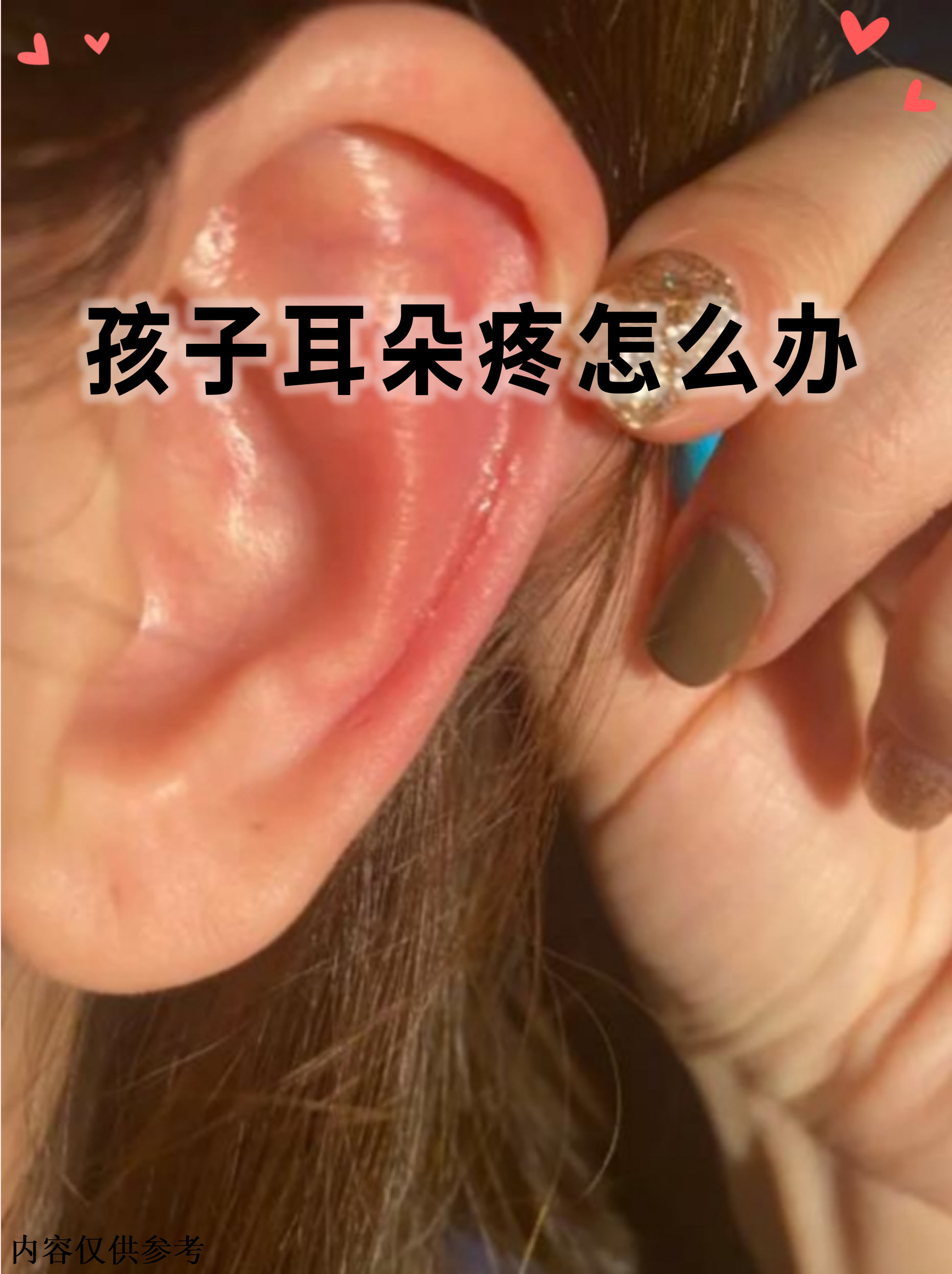 疼痛程度从轻微不适到剧烈难忍不等,及时正确处理能避免并发症