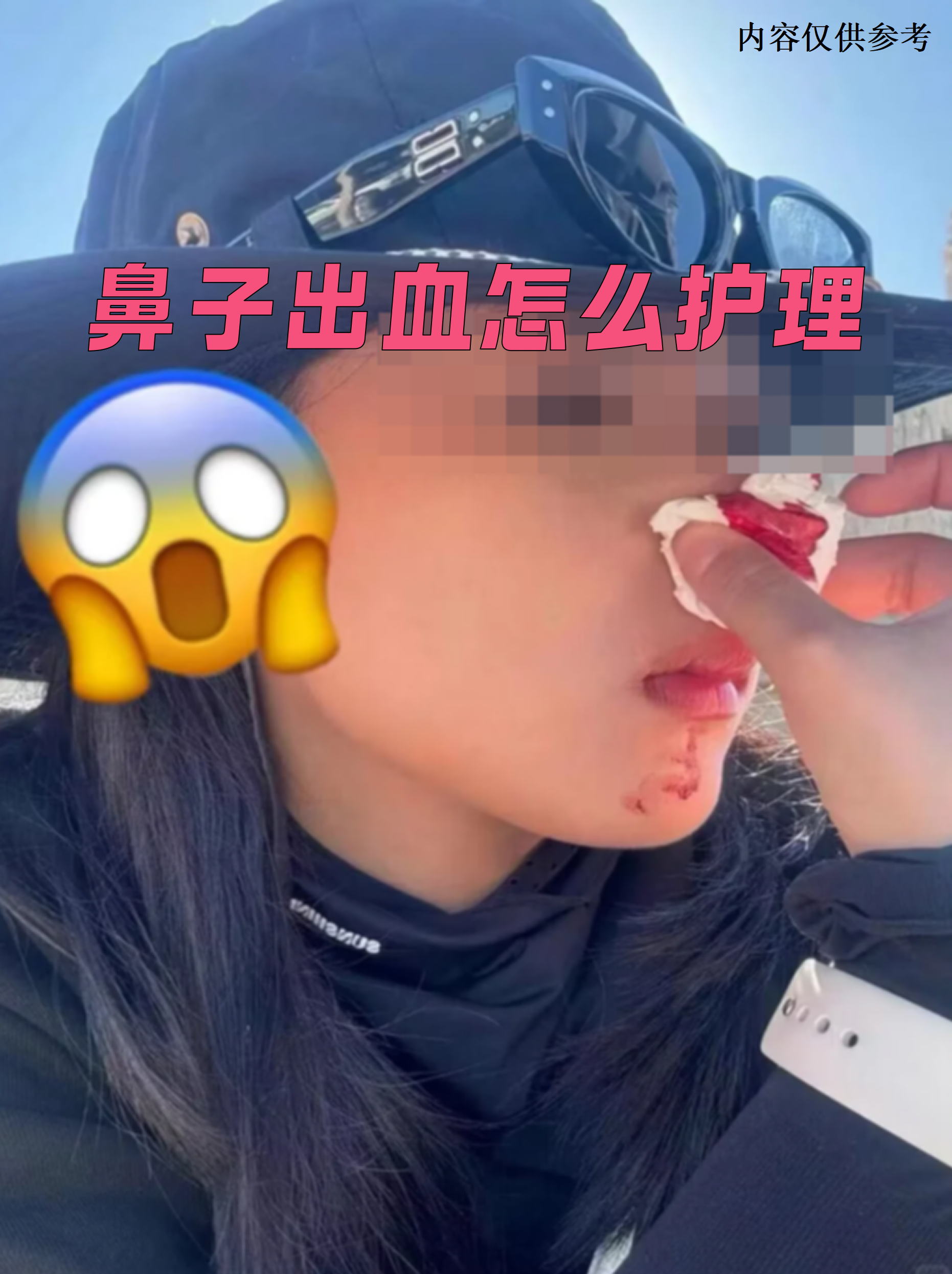 流鼻血时别慌,正确处理能快速止血并减少不适感