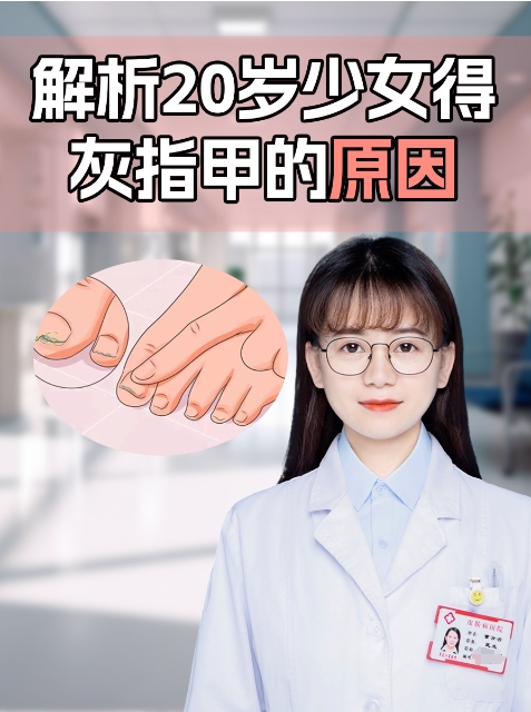 为什么会得灰指甲?多是由这4种因素造成的为什么在线 为什么会得灰指甲?多是由这4种因素造成的为什么在线