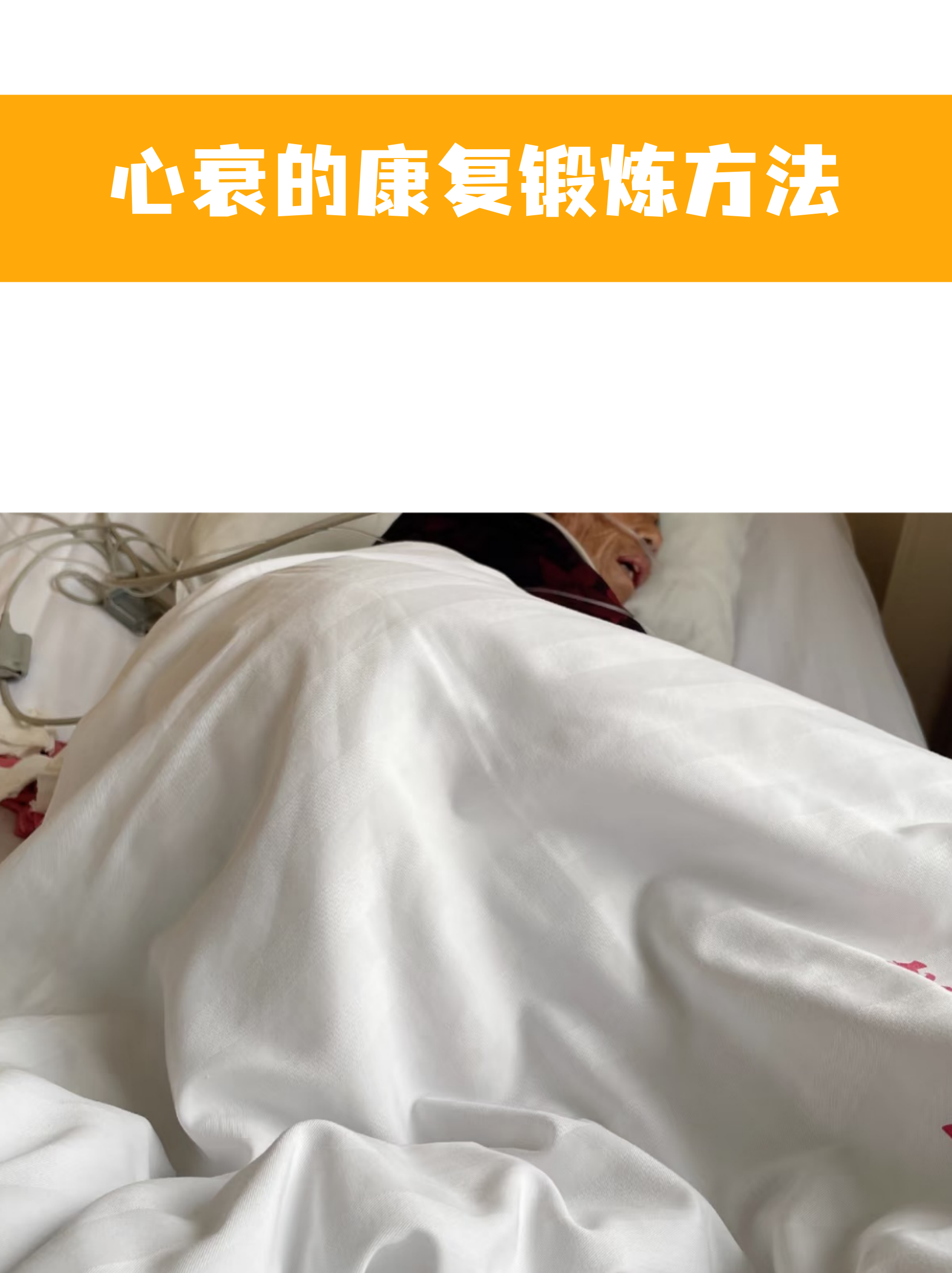 心脏康复锻炼是心衰患者管理的重要环节,科学运动能改善心肺功能,但