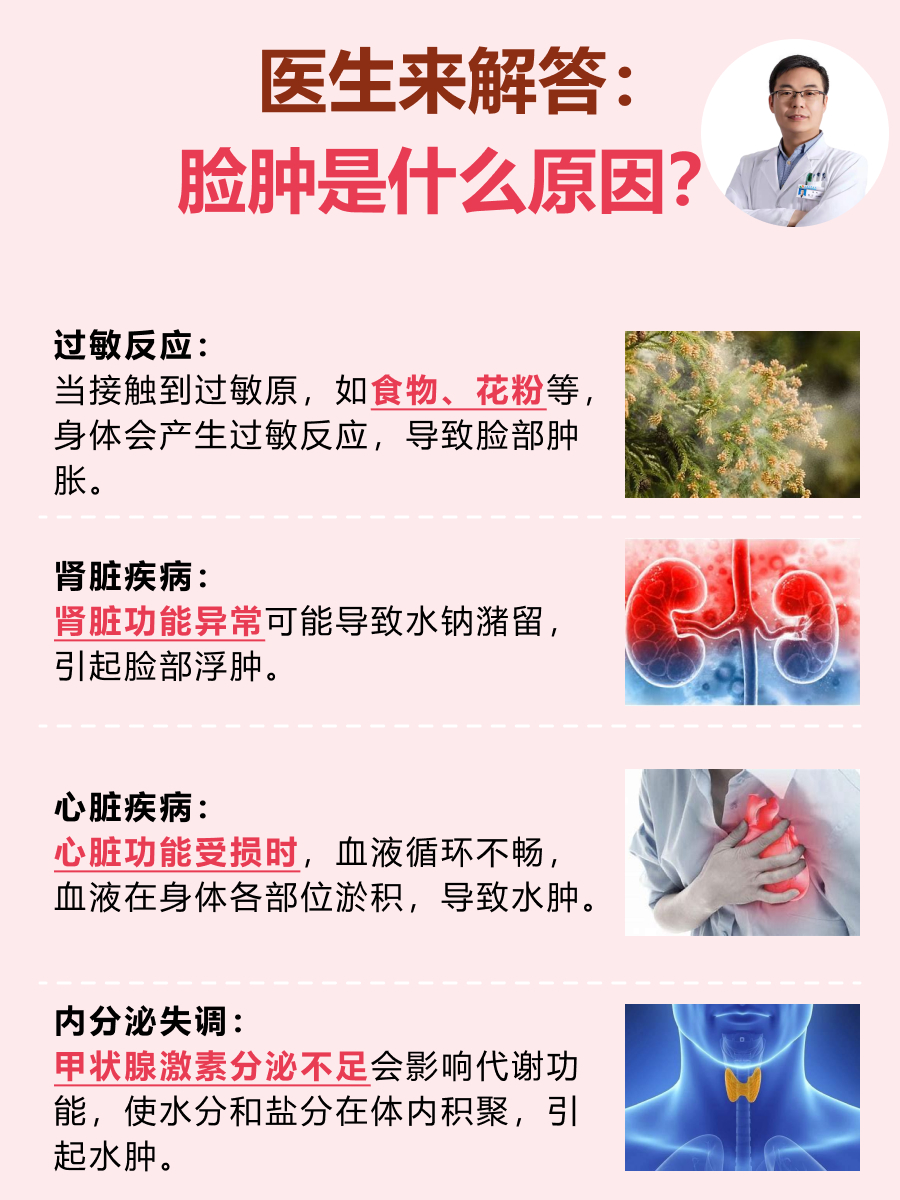 脸肿是一种较为常见的现象,可能由多种原因引起